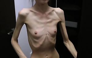 Anorexic Denisa posing and has ribs la-di-da orlah-di-dah