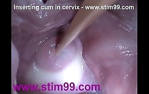 Flyer spunk cum give cervix close by distention wet crack send back